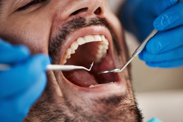 Best Emergency Dental Care for Broken or Chipped Teeth in Laconia, NH